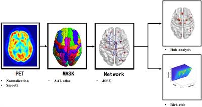 Alternation of the Rich-Club Organization of Individual Brain Metabolic Networks in Parkinson’s Disease